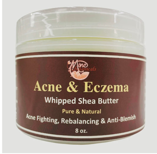 ACNE & ECZEMA
Whipped Shea Butter image 1